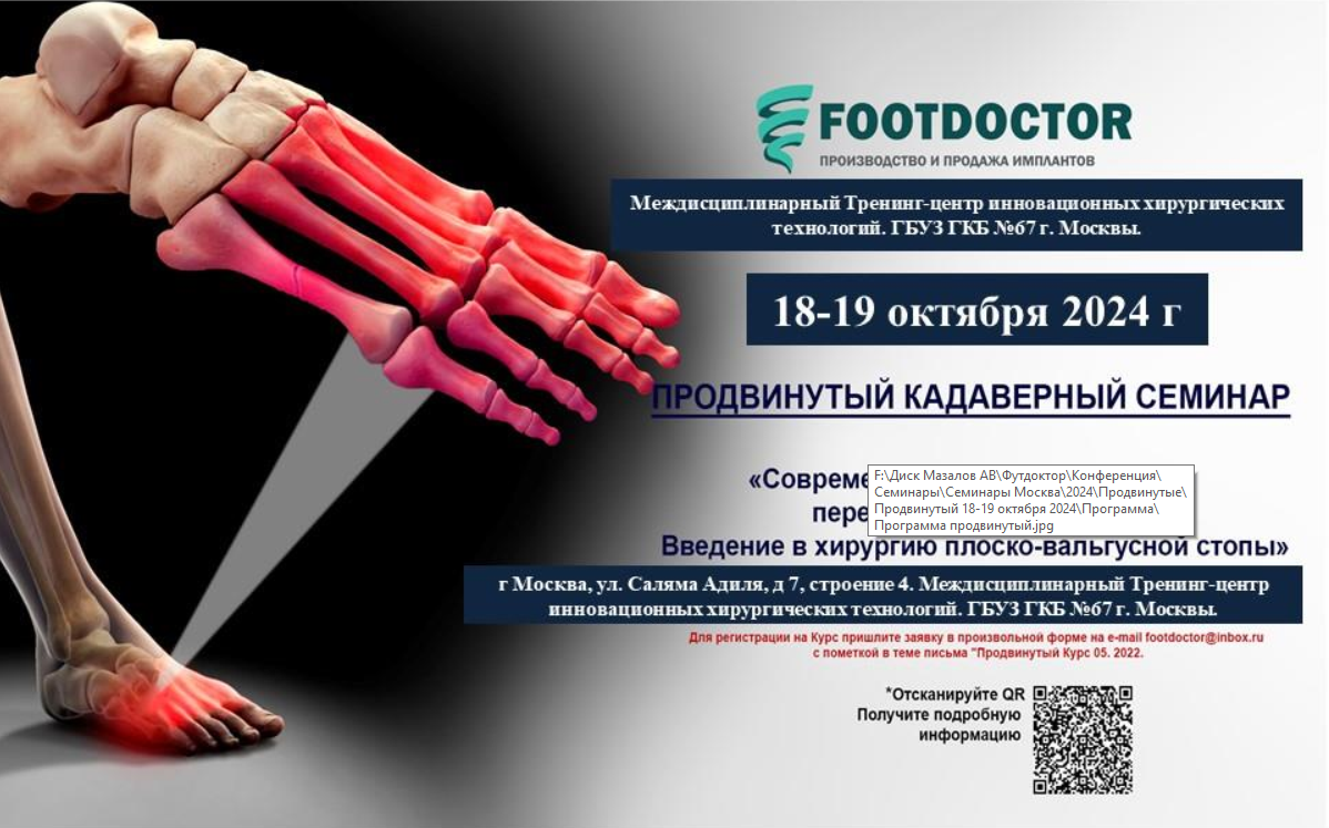 Footdoctor, производство и продажа имплантов — Footdoctor